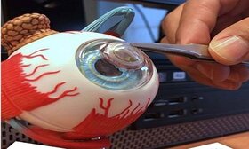 تولید اولین لنز تماسی الکترونیک چشم در بلژیک